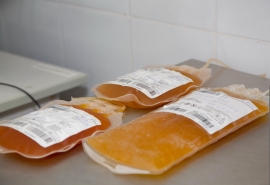 В омском Минздраве прокомментировали отсутствие в онкодиспансере оборудования для заморозки плазмы крови