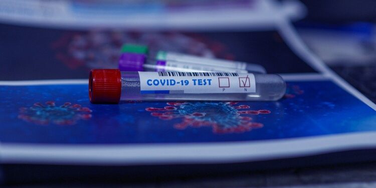 В России появится тест, способный выявлять коронавирус за 10 минут