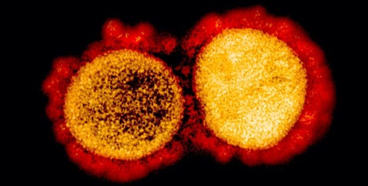 Названы причины низкой смертности от коронавируса в Германии
