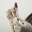 Люди с первой группой крови реже остальных болеют коронавирусом